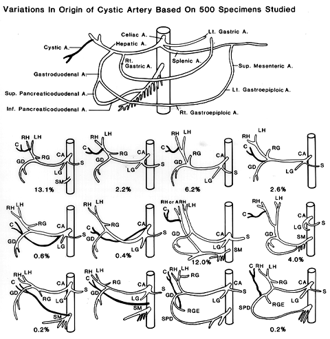 Image of variations in origin of cystic artery