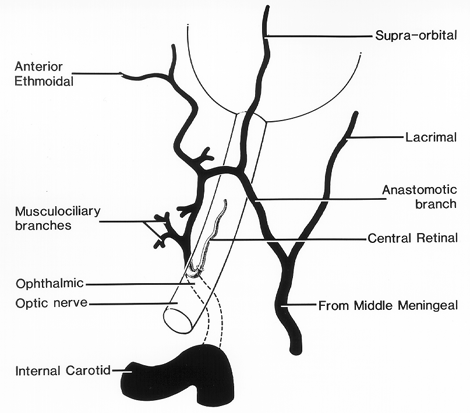 Image of variation in ophthalmic and retinal artery