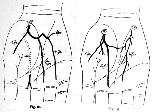 Image of some some variations in deep palmar arch