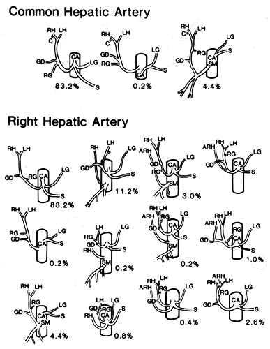 Image of common hepatic and right hepatic artery variations