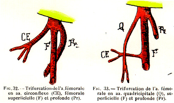 Image of trifurcation of the femoral