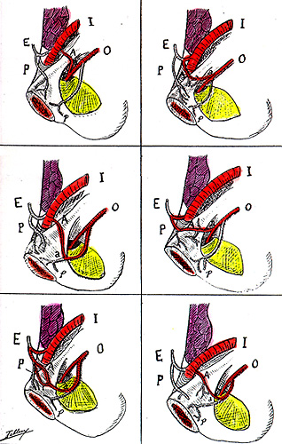 Image of variations in anstomoses