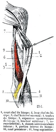 Image of a humeral third head of biceps branchii