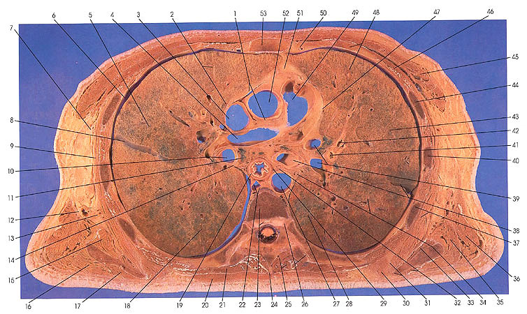 Plate 3.1