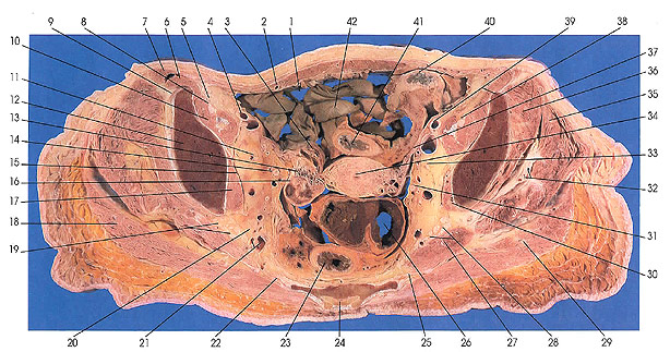 Plate 6.25