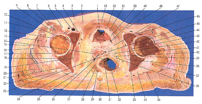 Plate 6.28