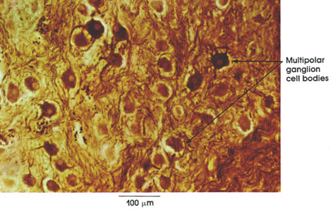 Plate 6.107 Sympathetic Ganglion Cells