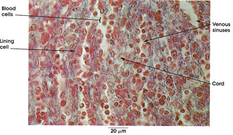 Plate 9.175 Spleen: Red Pulp