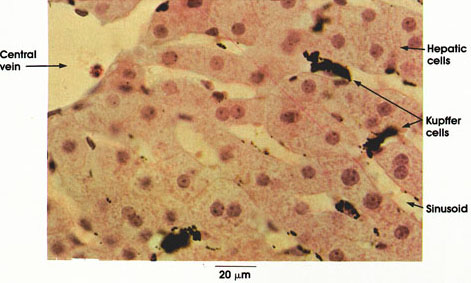 Plate 10.219 Liver: Phagocytic Kupffer Cells