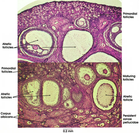 Plate 13.248 Ovary: Cortical Region