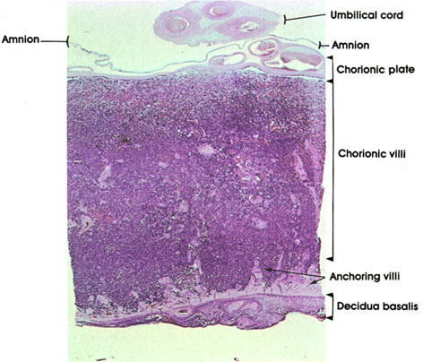 Plate 13.258 Placenta
