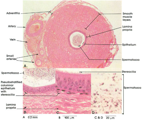 Plate 14.272 Vas Deferens