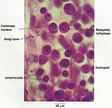 Plate 3.29: Plasma Cells