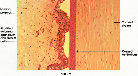 Plate 16.300 Conjunctiva and Cornea