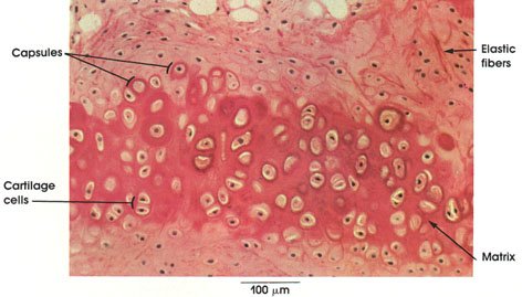 Plate 3.42: Elastic Cartilage