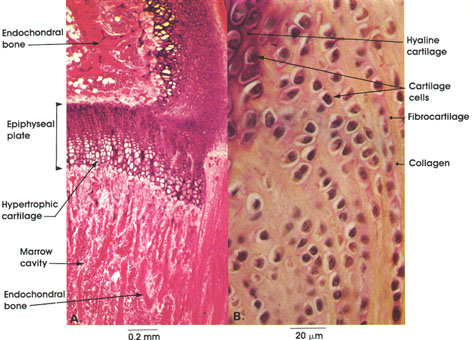 Plate 3.47: Endochondral Bone and Fibrocartilage