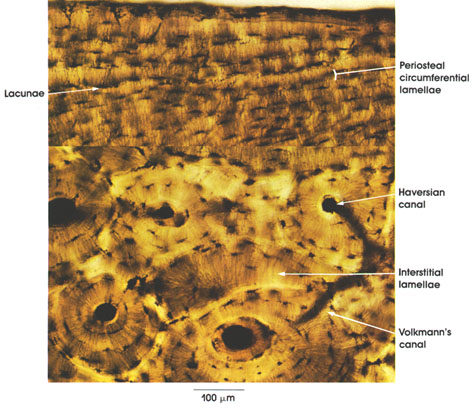 Plate 3.49: Bone