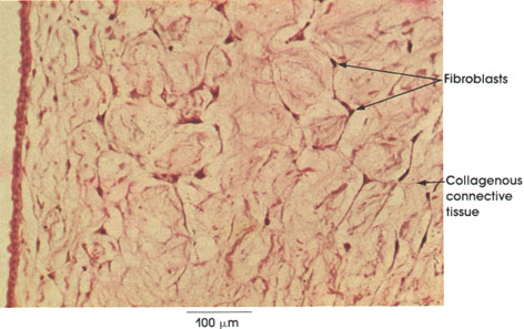 Plate 3.51: Mucous Connective Tissue