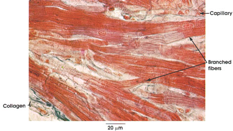 Plate 5.75: Cardiac Muscle