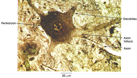 Plate 6.89 Lower Motor Neuron