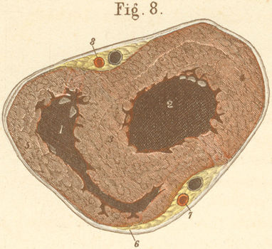 Cross section through both ventricles