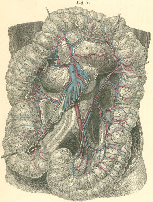 The large intestine with its blood vessels, after removal of the small intestine
