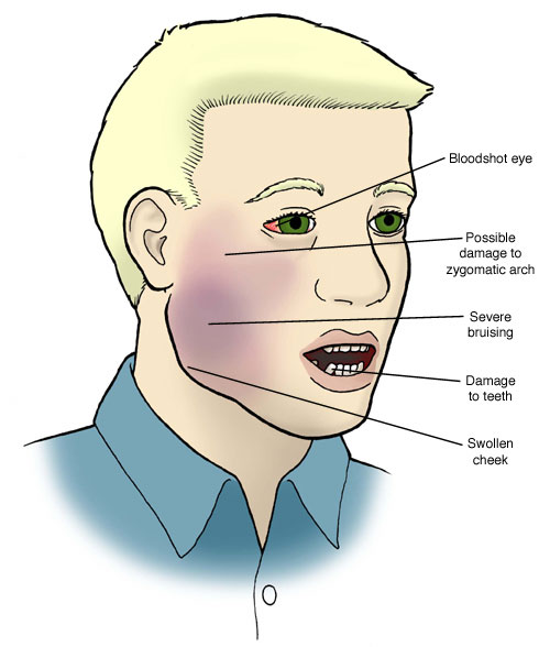 Oral facial pain treatment center wisconsin