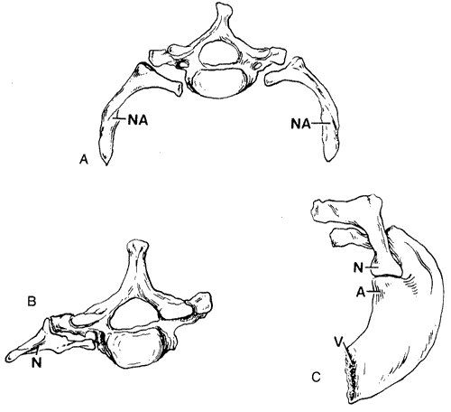 Cervical Rib Anatomy
