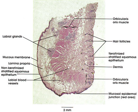 nonkeratinized stratified squamous epithelium mouth
