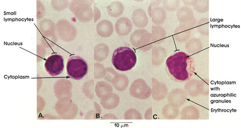 Lymphocytes Under Microscope